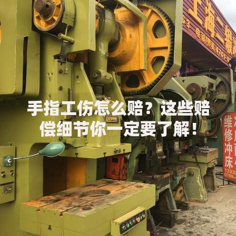 手指工伤怎么赔？这些赔偿细节你一定要了解！