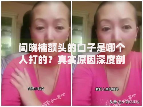 闫晓楠额头的口子是哪个人打的？真实原因深度剖析