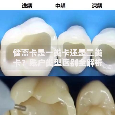 储蓄卡是一类卡还是二类卡?账户类型区别全解析 储蓄卡是一类卡还是二类卡?账户类型区别全解析