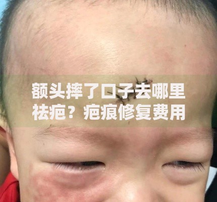 额头摔了口子去哪里祛疤？疤痕修复费用能否贷款解决