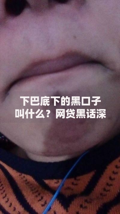 下巴底下的黑口子叫什么？网贷黑话深度解析