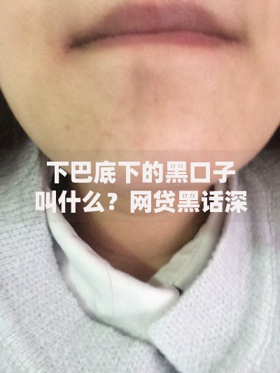 下巴底下的黑口子叫什么？网贷黑话深度解析