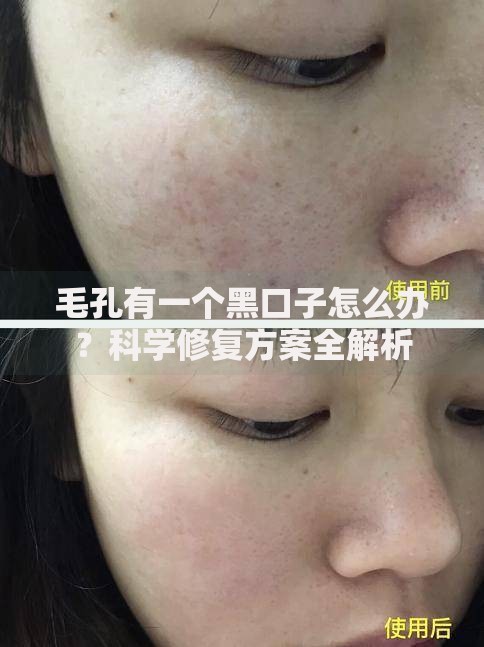毛孔有一个黑口子怎么办？科学修复方案全解析